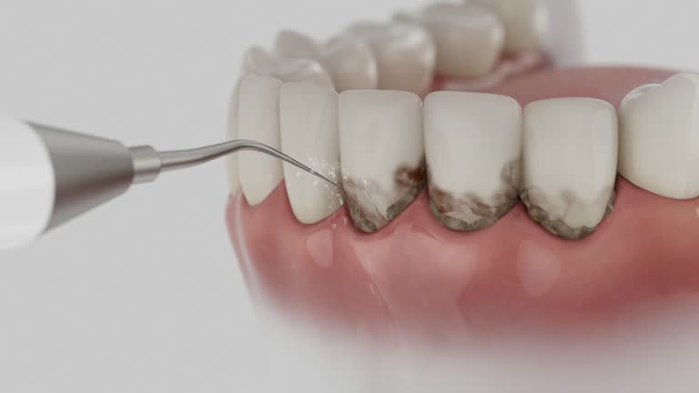 Reliable Dental Implants contractor in Fishhook, AK by Smile Center Dentistry